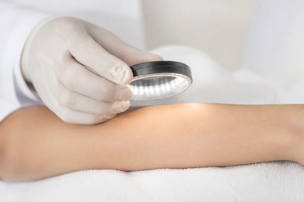 Examen cutané préalable et vérification des contre-indications